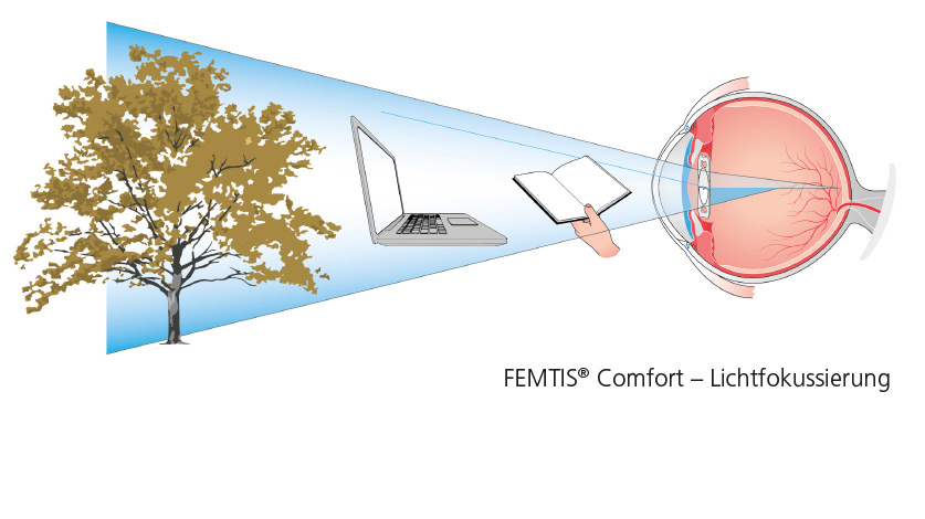 FEMTIS Comfort Lichtfokussierung DE neu