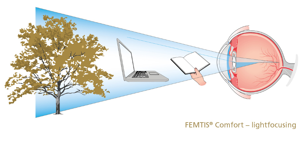 FEMTIS Comfort Lichtfokussierung EN neu