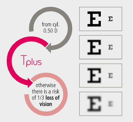 Abb. Vision loss EN