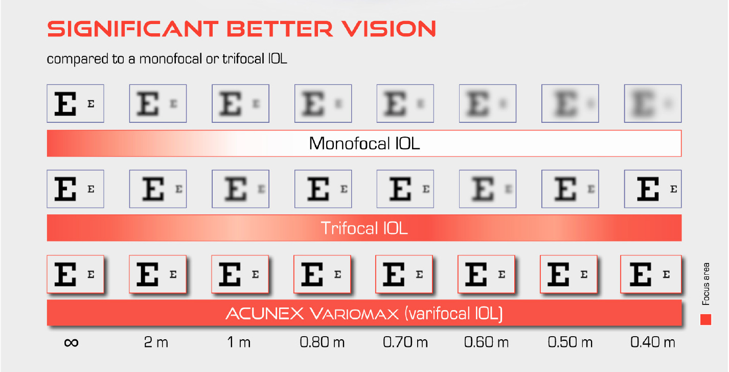 Abb. Significant better vision