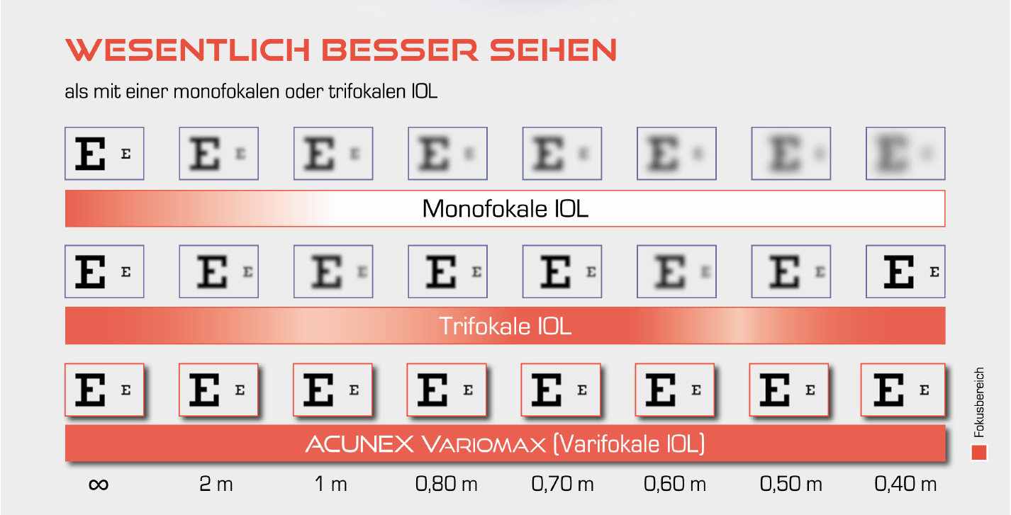 Abb. Wesentlich besser sehen