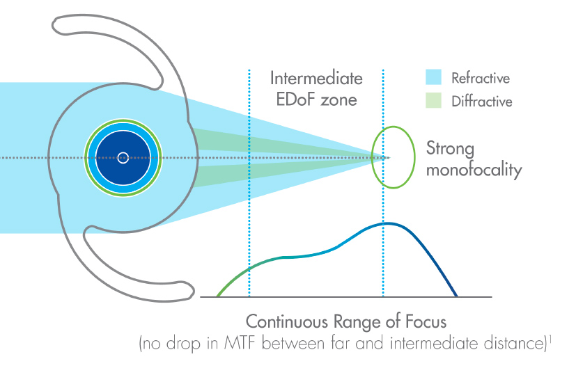 Abb. Continuous range of focus