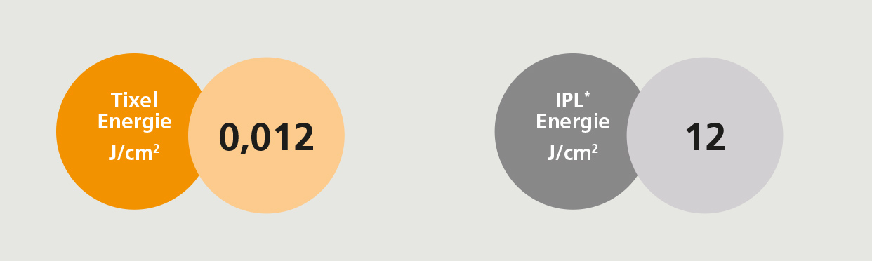 Abb. Energienioveau-Vergleich Tixel – IPL