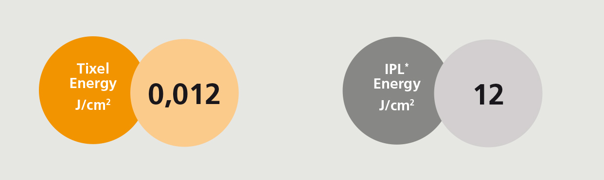Energie-Level Tixel vs. IPL englisch