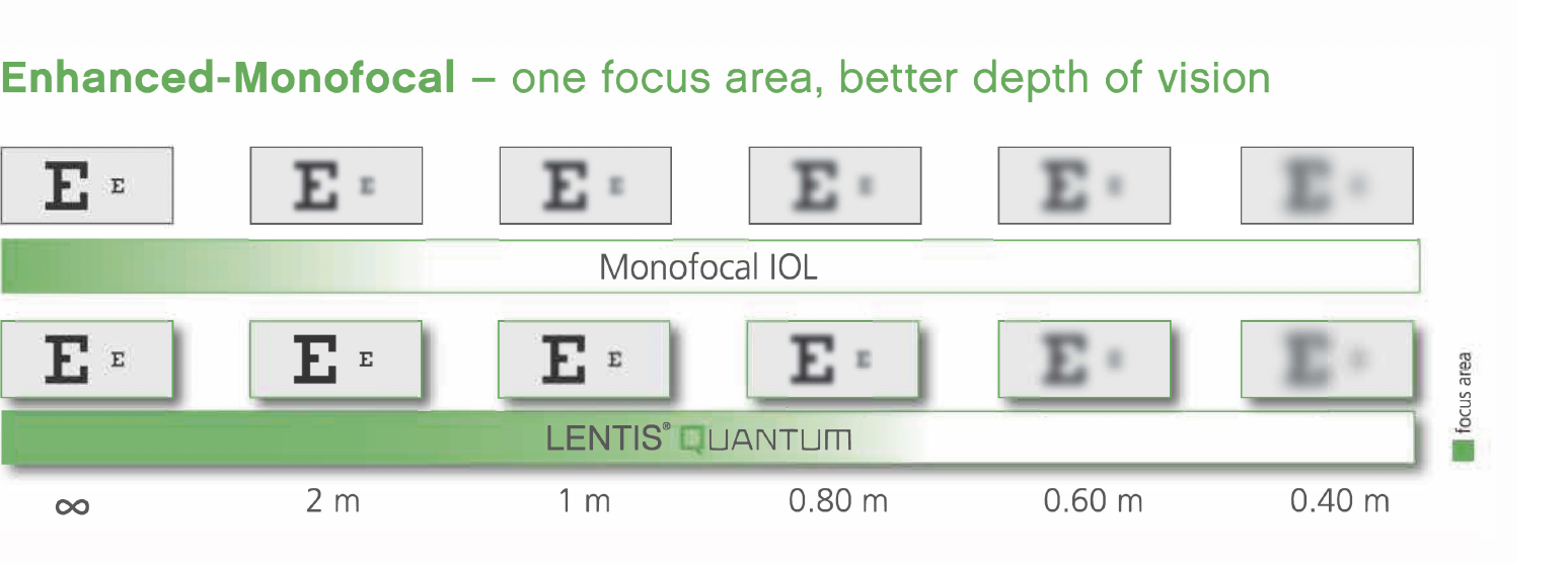 Lentis Quantum Enhanced Monofocal EN