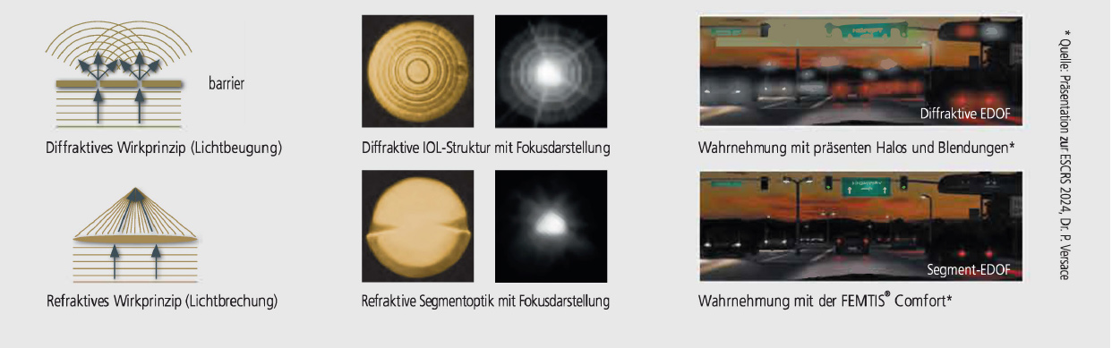 FEMTIS Comfort Einzigartige refraktive Segmentoptik DE