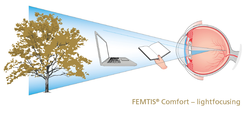 FEMTIS Comfort Lichtfokussierung EN