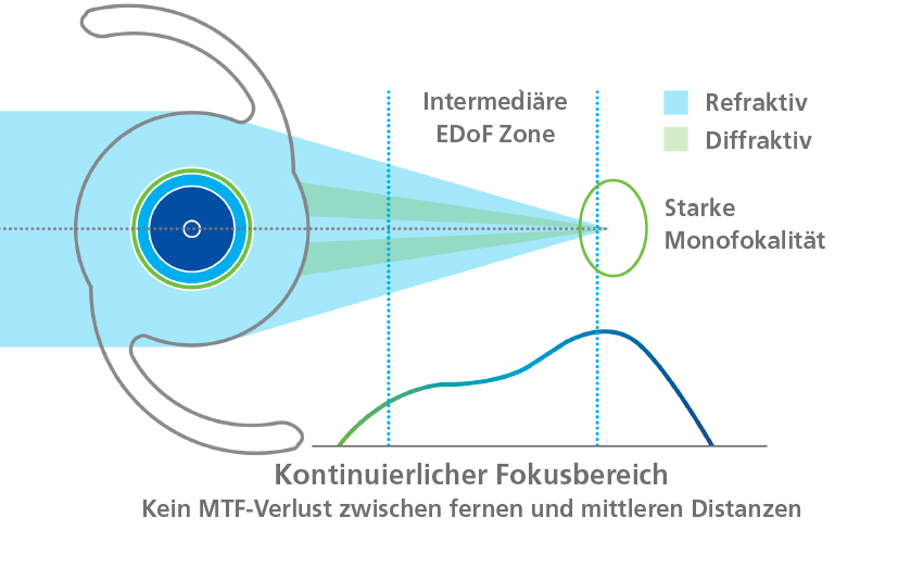 Abb. Kontinuierlicher Fokusbereich DE