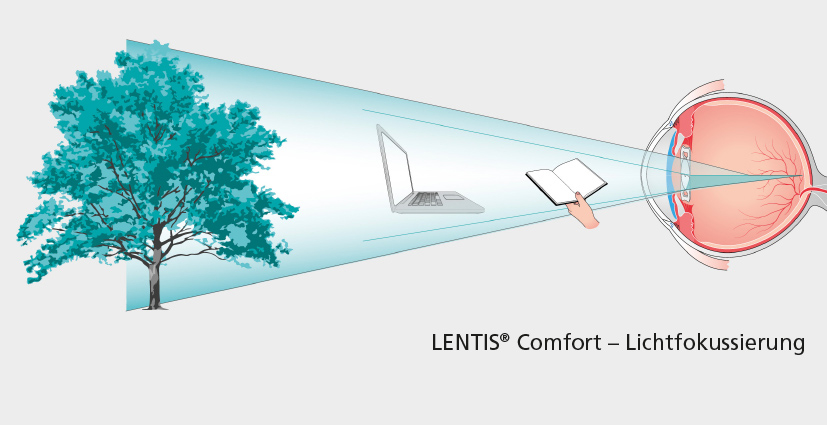 Lichtfokussierung LENTIS Comfort