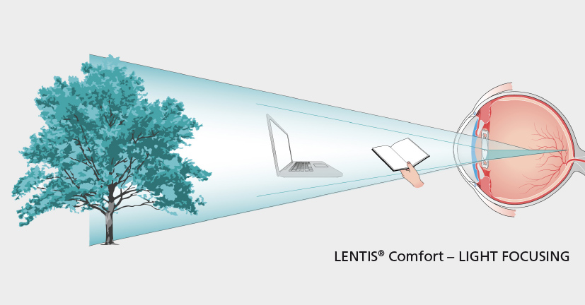 Abb. LENTIS Comfort Lichtfokussierung EN