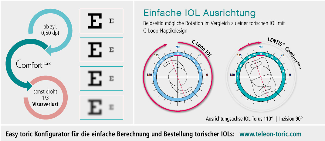 Abb. LENTIS Comfort Toric