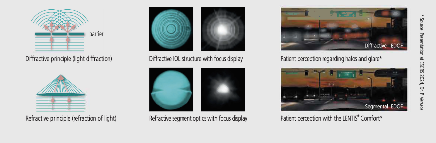 LENTIS Comfort Unique refractive segment optics