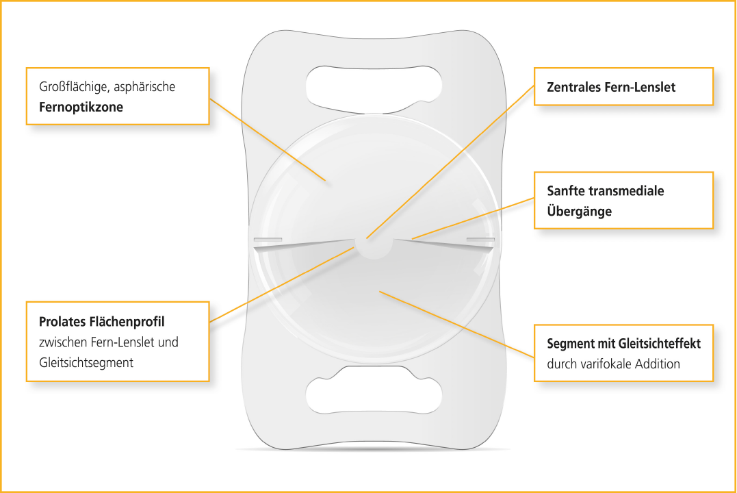 LENTIS Mplus Abb. Continuous Transmission Technology DE neu
