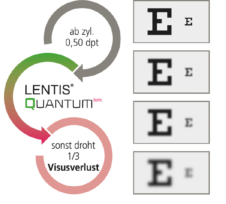 Abb. Visusverlust DE