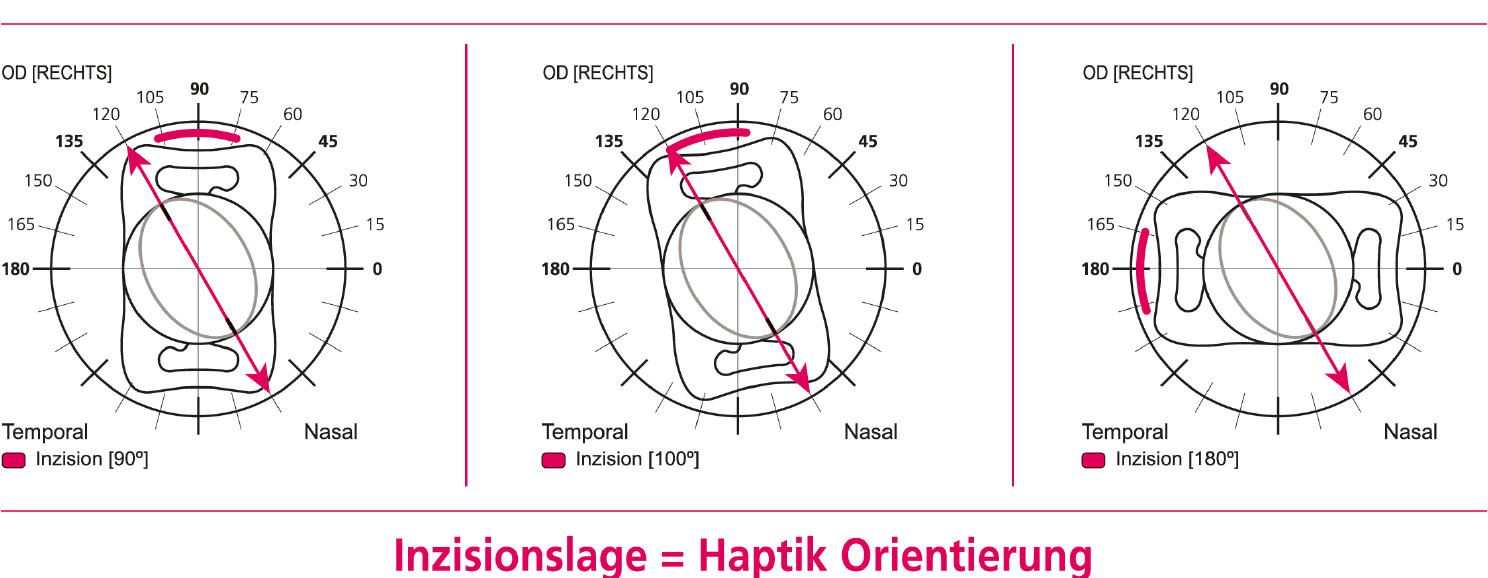 Grafik individuelle Anfertigung in 0,01 dpt Schritten DE