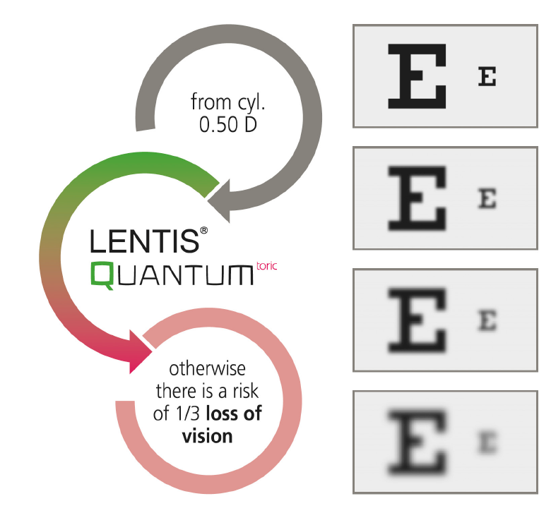 Vision Loss EN